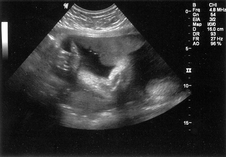 Fonzarelli Thumbs Up