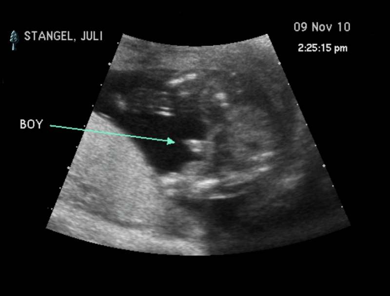 "IT'S A BOY"